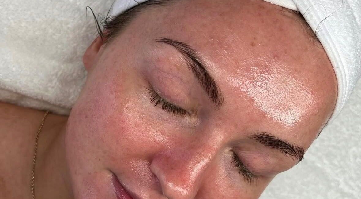 Close-up of a facial treatment at Cove skin clinic, Hornchurch, England, GB, showcasing glowing skin.