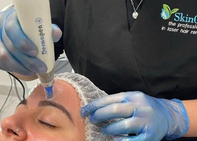 Dermapen facial treatment at Skin Clear, Coolaroo, Victoria, AU. Enhancing skin rejuvenation.