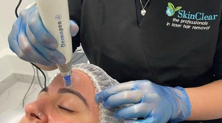 Dermapen facial treatment at Skin Clear, Coolaroo, Victoria, AU. Enhancing skin rejuvenation.