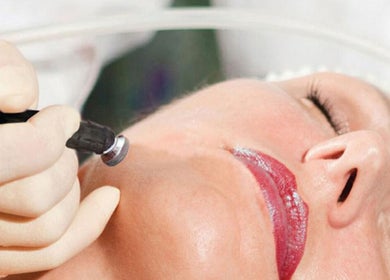 Close-up of a facial treatment at Skin Clear in Coolaroo, Victoria, AU showcasing expert skincare services.