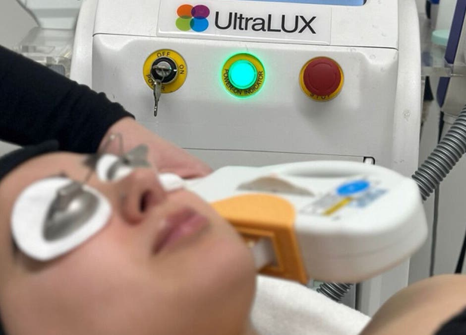 Client receiving skin treatment at Skin Clear in Coolaroo, Victoria, AU, using advanced UltraLUX technology.