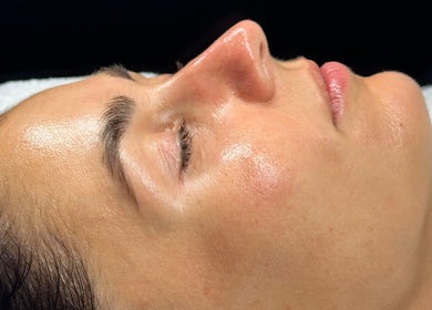 Close-up of a glowing skin treatment at LUXURY SKINCARE STUDIO, Bloomington, Minnesota, US.