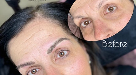 Dermabrow