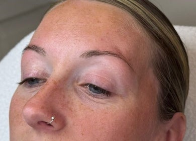Close-up of a face showing radiant skin after treatment at Skin Aesthetics by Becki in Truro, England, GB.
