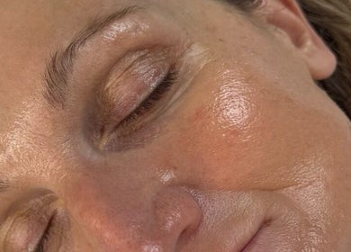 Close-up of a serene glowing face after treatment at Skin Aesthetics by Becki Penzance, Penzance, England, GB.
