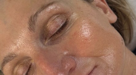 Close-up of a serene glowing face after treatment at Skin Aesthetics by Becki Penzance, Penzance, England, GB.