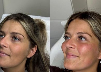 Client glowing after treatment at Skin Aesthetics by Becki Penzance, located in Penzance, England, GB.