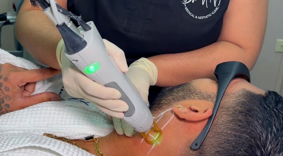 Laser treatment at Curepe-Dr Avinash Nath Clinic & Spa, Tunapuna/piarco Regional Corporation, TT.