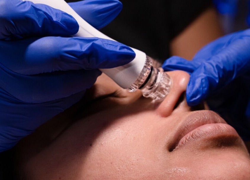 Close-up of a hydrafacial at Curepe-Dr Avinash Nath Clinic in Tunapuna/Piarco Regional Corporation, TT.