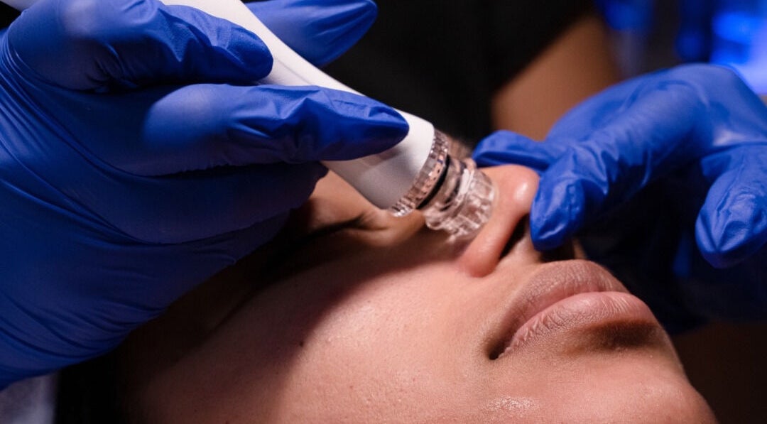 Close-up of a hydrafacial at Curepe-Dr Avinash Nath Clinic in Tunapuna/Piarco Regional Corporation, TT.