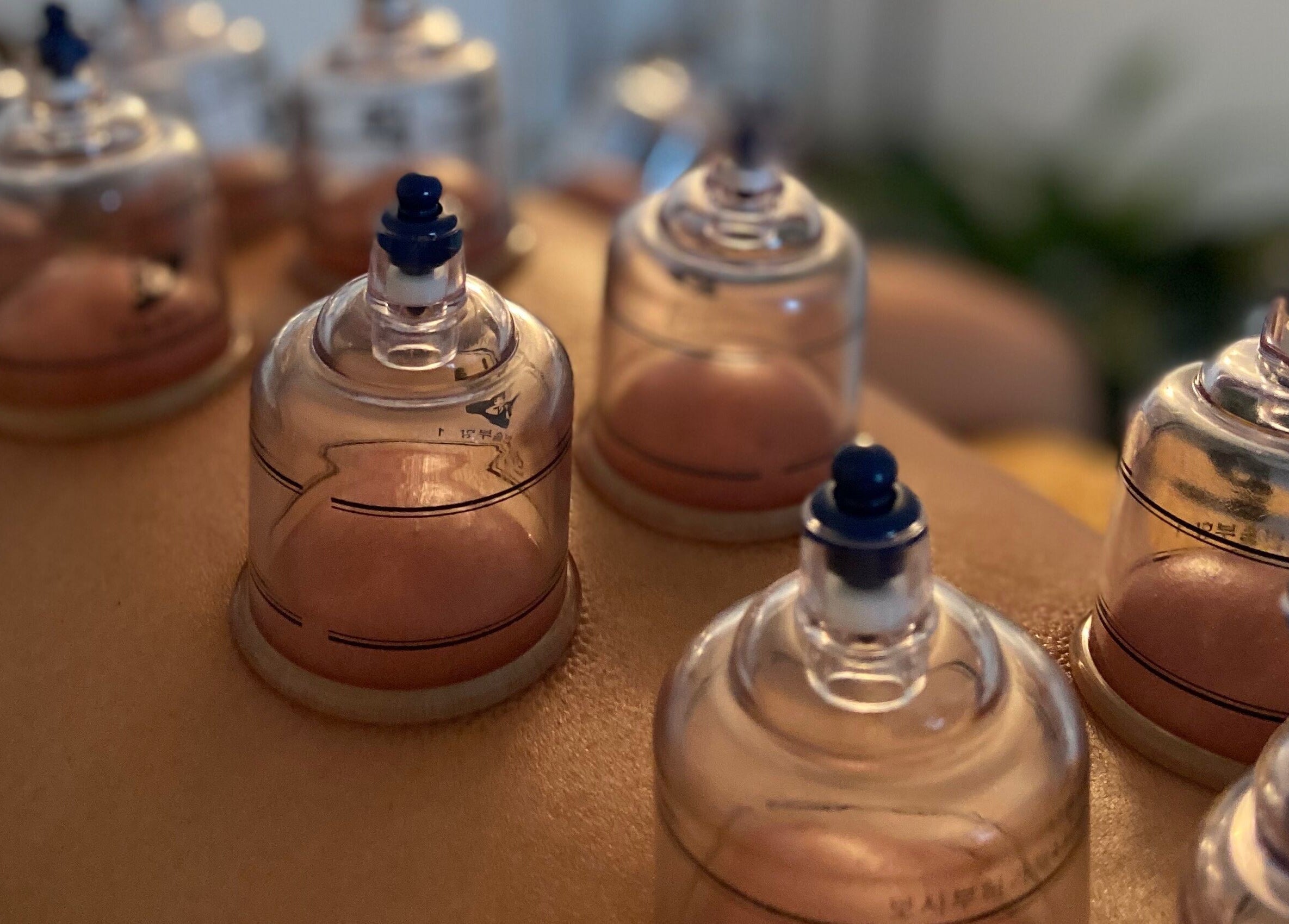 Cupping therapy session at Muscle Relief in Narre Warren South, Victoria, AU.