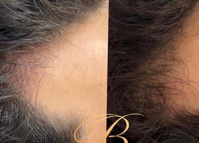 Hair treatment at The Bloom Aesthetics, Hereford, England, GB showing before and after results.