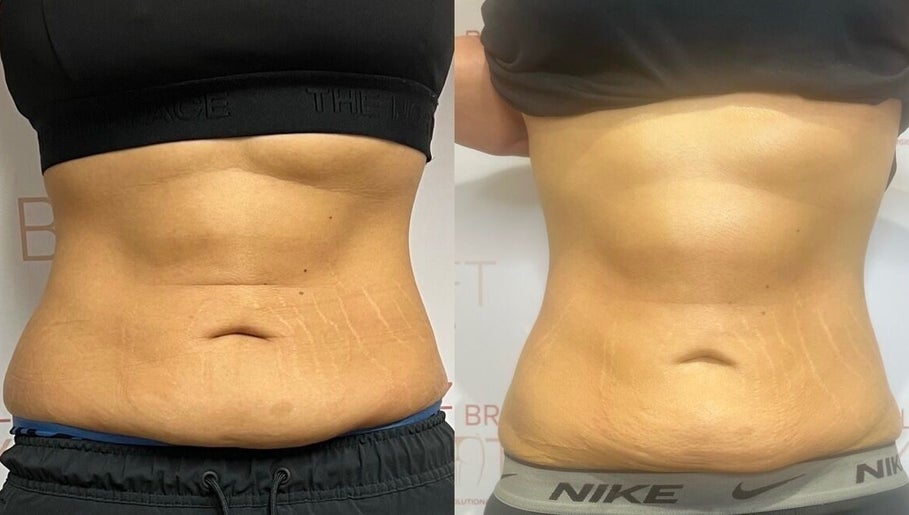 HM Body Sculpting image 1
