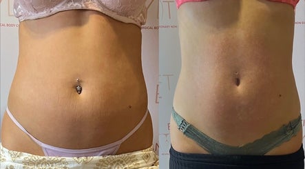 HM Body Sculpting image 3