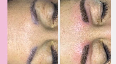 Glow Beauty and Aesthetics Studio