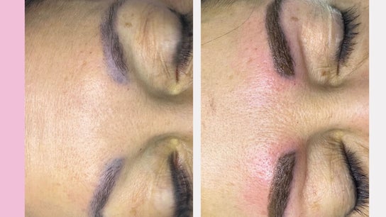 Glow Beauty and Aesthetics Studio