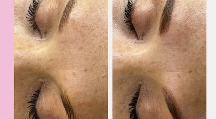 Glow Beauty and Aesthetics Studio, bilde 2