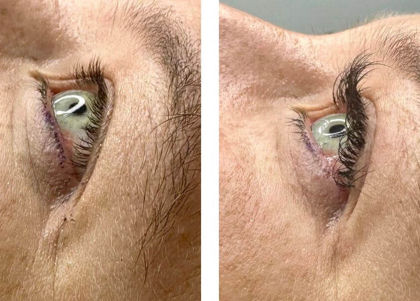 Eye lash enhancement at Glow Beauty and Aesthetics Studio, Pretoria, Gauteng, ZA. Visible results of treatment.