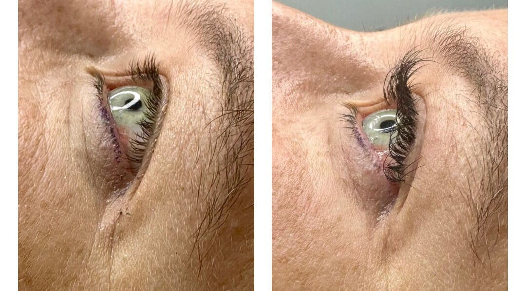 Eye lash enhancement at Glow Beauty and Aesthetics Studio, Pretoria, Gauteng, ZA. Visible results of treatment.