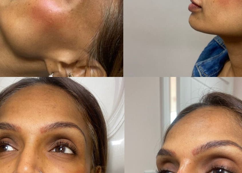 Close-up of aesthetic skincare results at Ebbsfleet Aesthetics, Northfleet, England, GB.