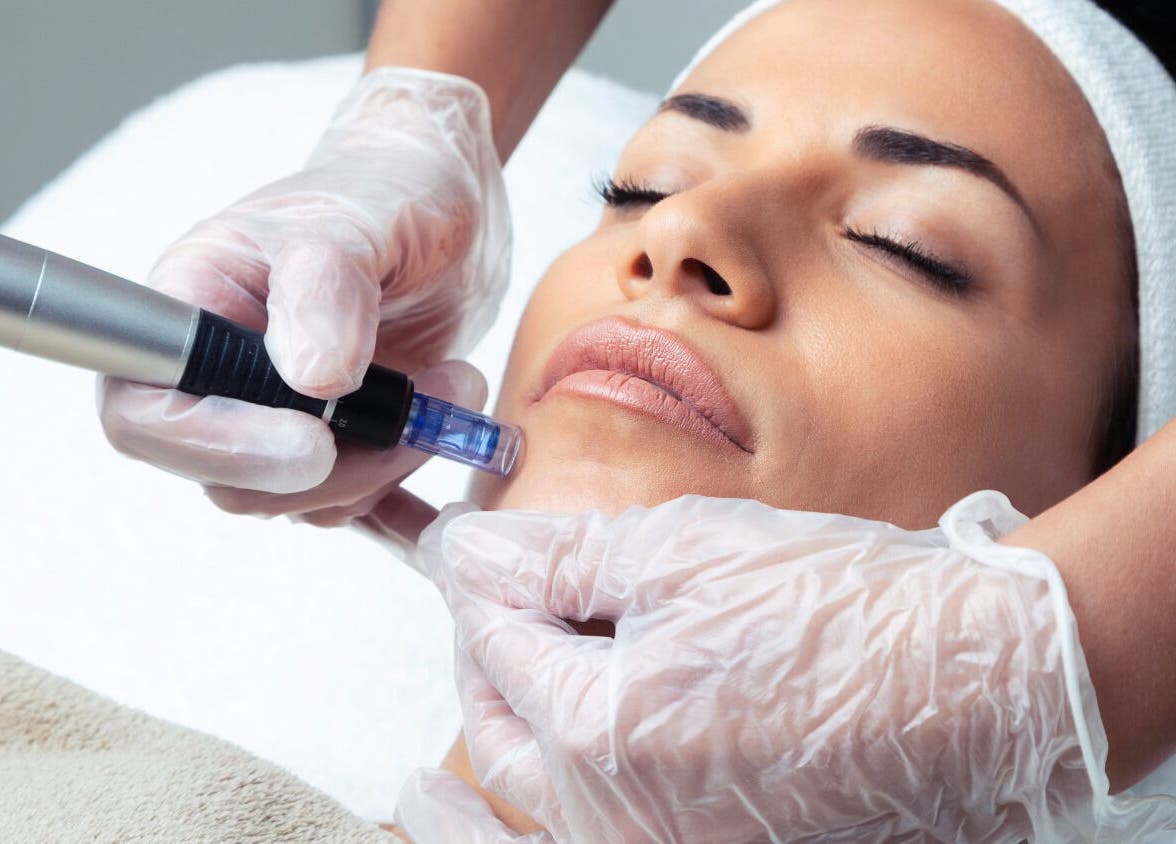 Facial treatment at De-Vaux Aesthetics, Tattingstone, England, GB, showcasing advanced skincare procedures.