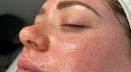 Polished Pores