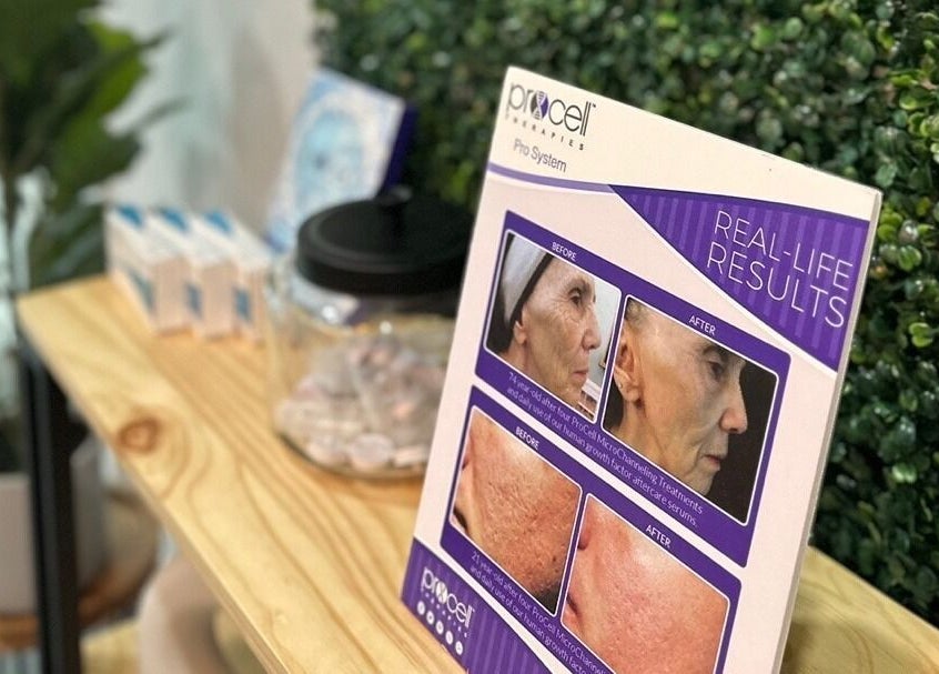 Procell transformation results displayed at Soo Healing Studio, Toronto, Ontario, CA.