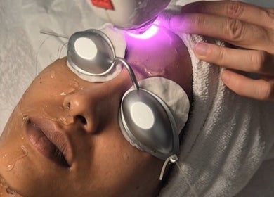 Tratamiento facial con láser en GEO'S | Estética Integral, Reus, Catalunya, ES.