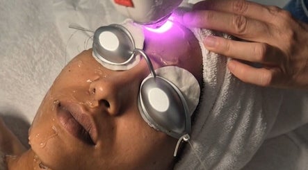 Tratamiento facial con láser en GEO'S | Estética Integral, Reus, Catalunya, ES.