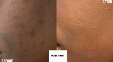 Maylahni Skin and Aesthetics Clinic: CLINIC APPOINTMENTS. Acne & Hyperpigmentation specialists – kuva 2