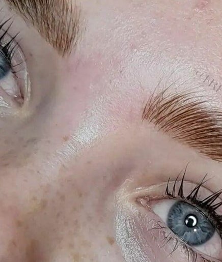 Freckles Beauty Spot, bilde 2