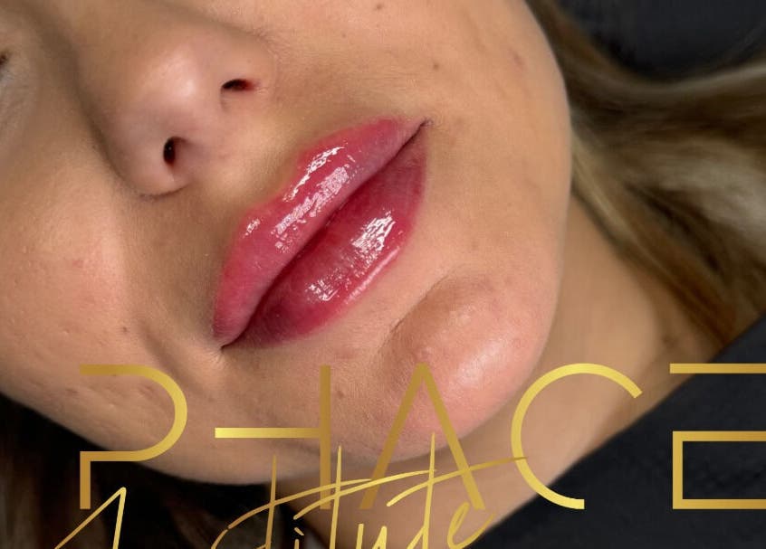 Close-up of glossy lips at Phace Institute in Belfast, Northern Ireland, GB, showcasing beauty treatment.