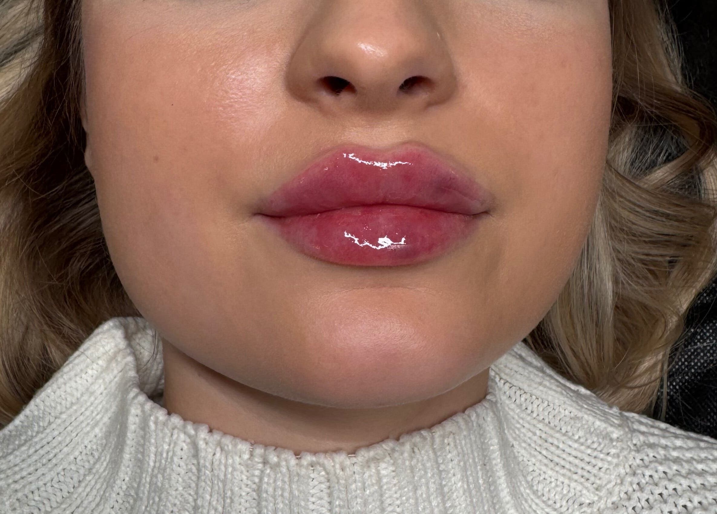 Close-up of glossy lips after treatment at Phace Institute in Belfast, Northern Ireland, GB.