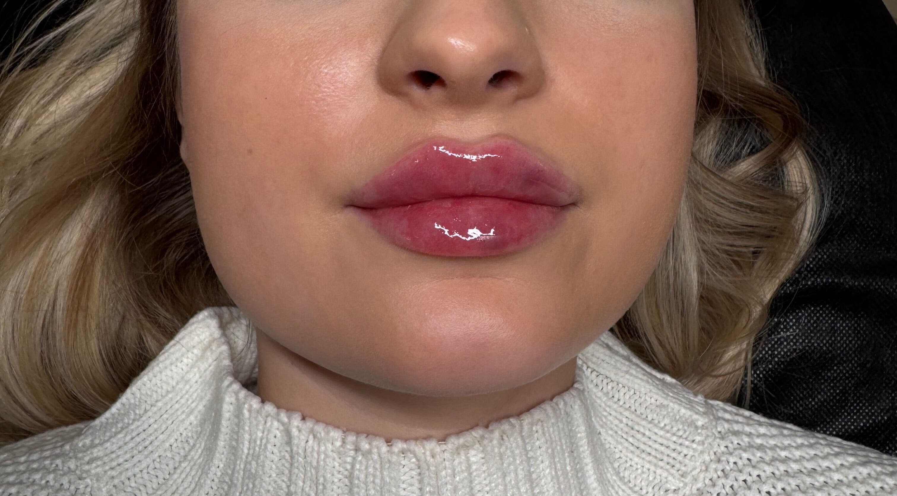 Close-up of glossy lips after treatment at Phace Institute in Belfast, Northern Ireland, GB.