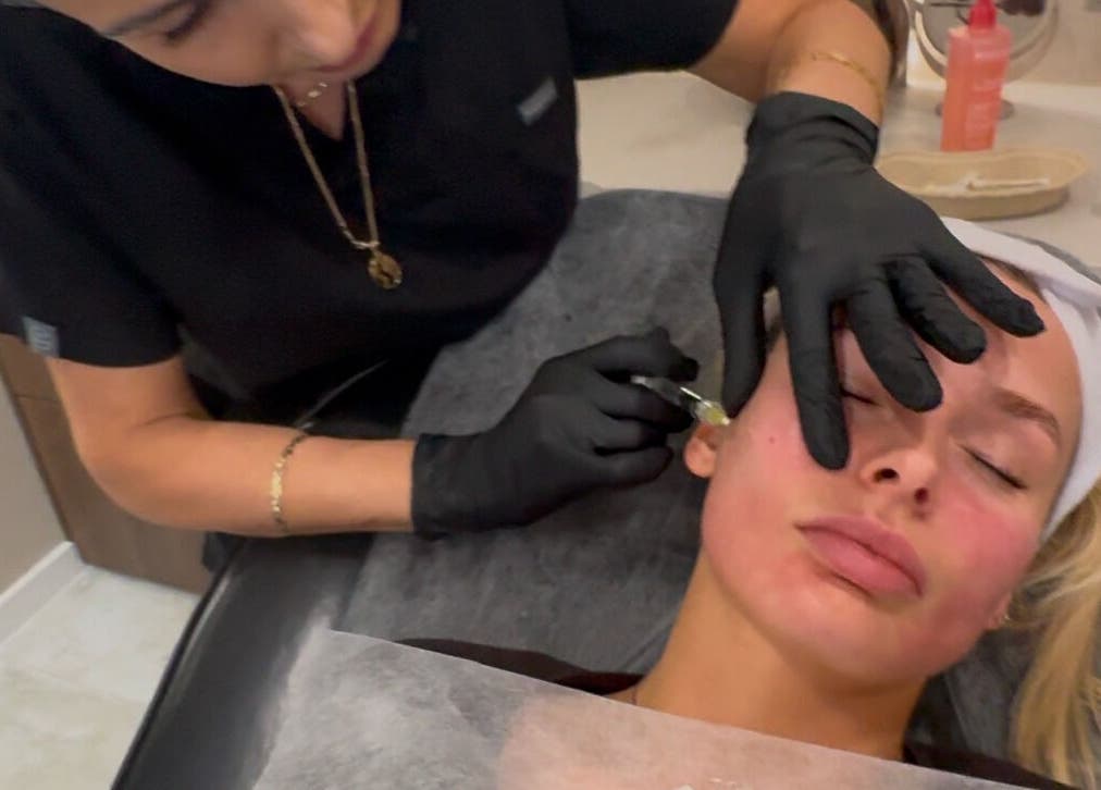 Facial rejuvenation at Phace Institute in Belfast, Northern Ireland, GB with precision skincare technique.