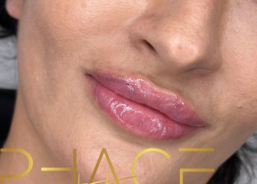 Close-up of glossy lips treated at Phace Institute, Belfast, Northern Ireland, GB.