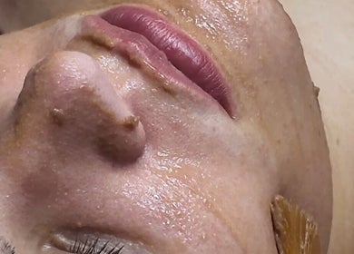 Close-up of a woman receiving a facial treatment at Signature Skin, Taverham, England, GB.