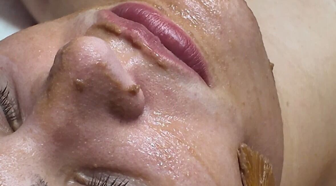 Facial treatment at Signature Skin, Taverham, England, GB rejuvenates complexion for youthful glow.