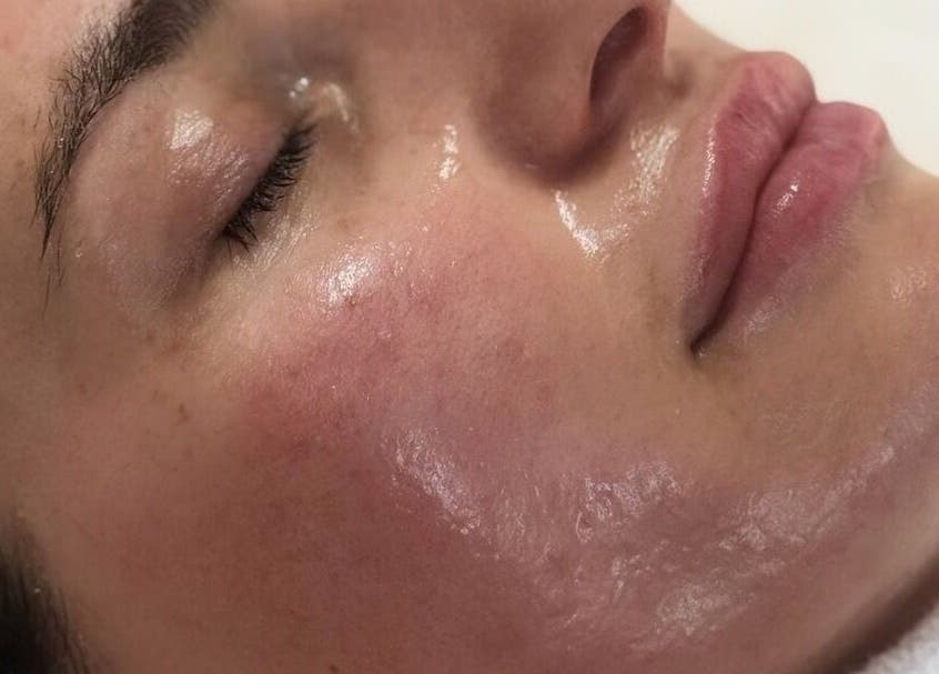 Facial treatment at Luminous with Lil in Barrow-in-Furness, England, GB, showing smooth, glowing skin.