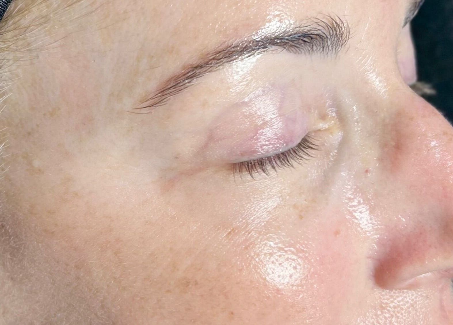 Close-up of glowing skin after treatment at Glow Studio Skin & Beauty, Hamilton, Ontario, CA.