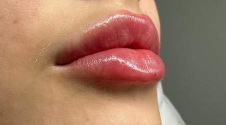 Refine Aesthetics- Injectables Clinic image 3