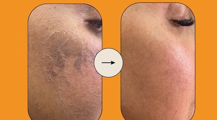 Sidra Beauty Clinic image 2