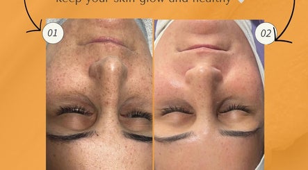 Sidra Beauty Clinic image 3