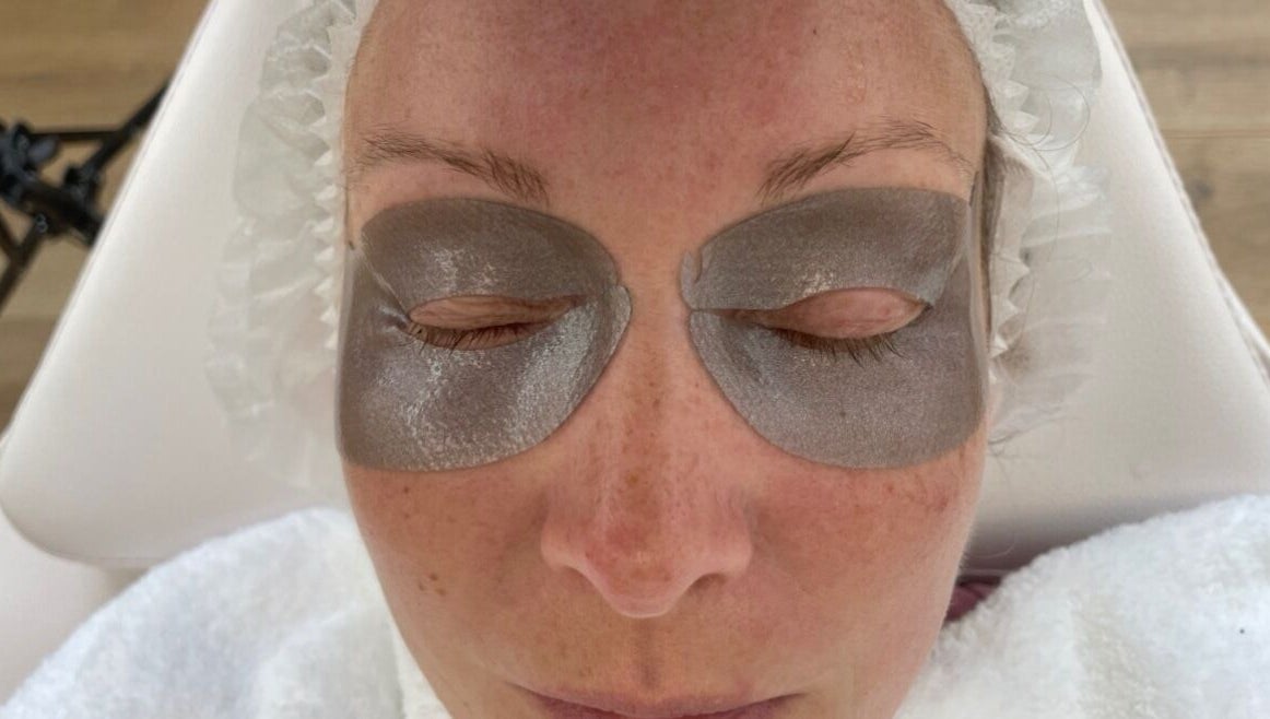 Rejuv by V eye mask treatment in Newcastle, England, GB with hydrating silver patches on closed eyes.