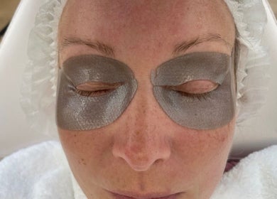 Rejuv by V eye mask treatment in Newcastle, England, GB with hydrating silver patches on closed eyes.