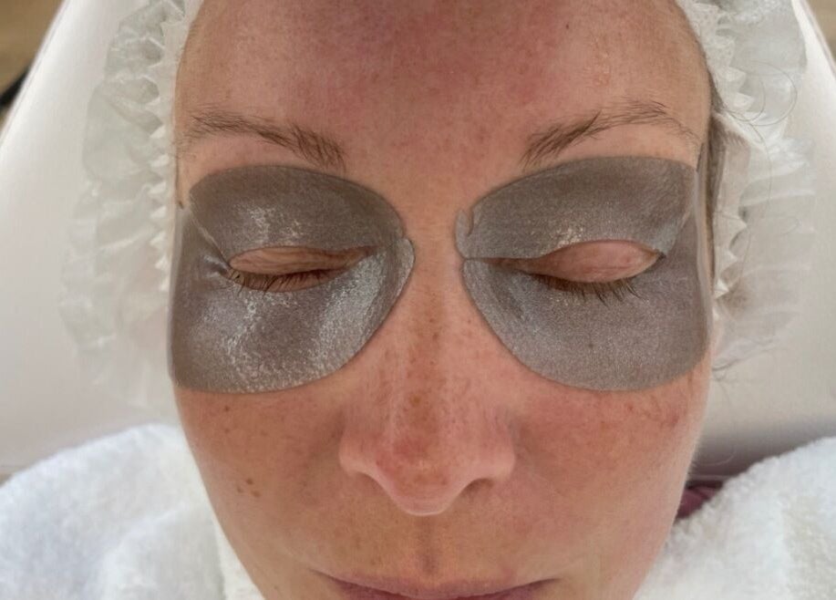 Rejuv by V eye mask treatment in Newcastle, England, GB with hydrating silver patches on closed eyes.