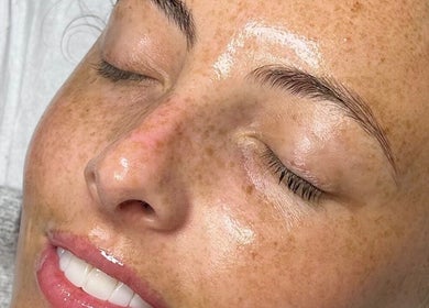 Radiant skin care result at LoLo in Horbury, England, GB, showcasing a glowing complexion.