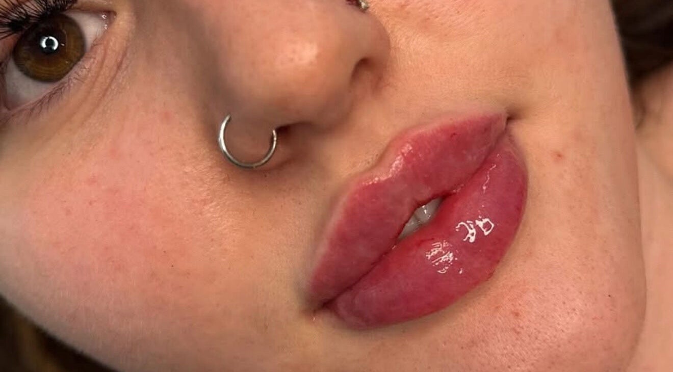 Close-up of glossy lips showcasing Yasmin kitchen aesthetics at HD Beauty in Fareham, England, GB.