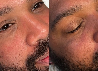 Close-up of rejuvenated skin after treatment at Lada Beauty Studio, Cape Town, Western Cape, ZA.