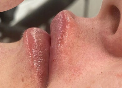 Close-up of glossy, hydrated lips after treatment at hd aesthetics Bearsted, Bearsted, England, GB.